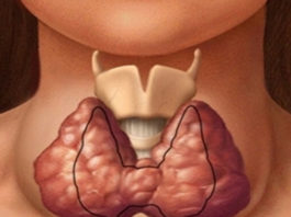 Щитовидная железа — это та, которая контролирует все тело! Вот как сохранить ее здоровье